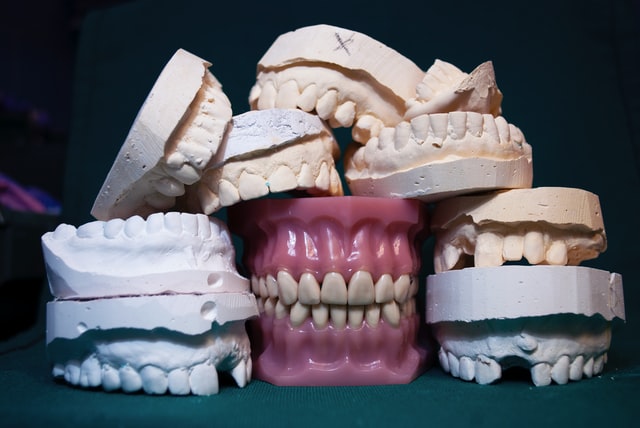 たくさんの入れ歯の模型