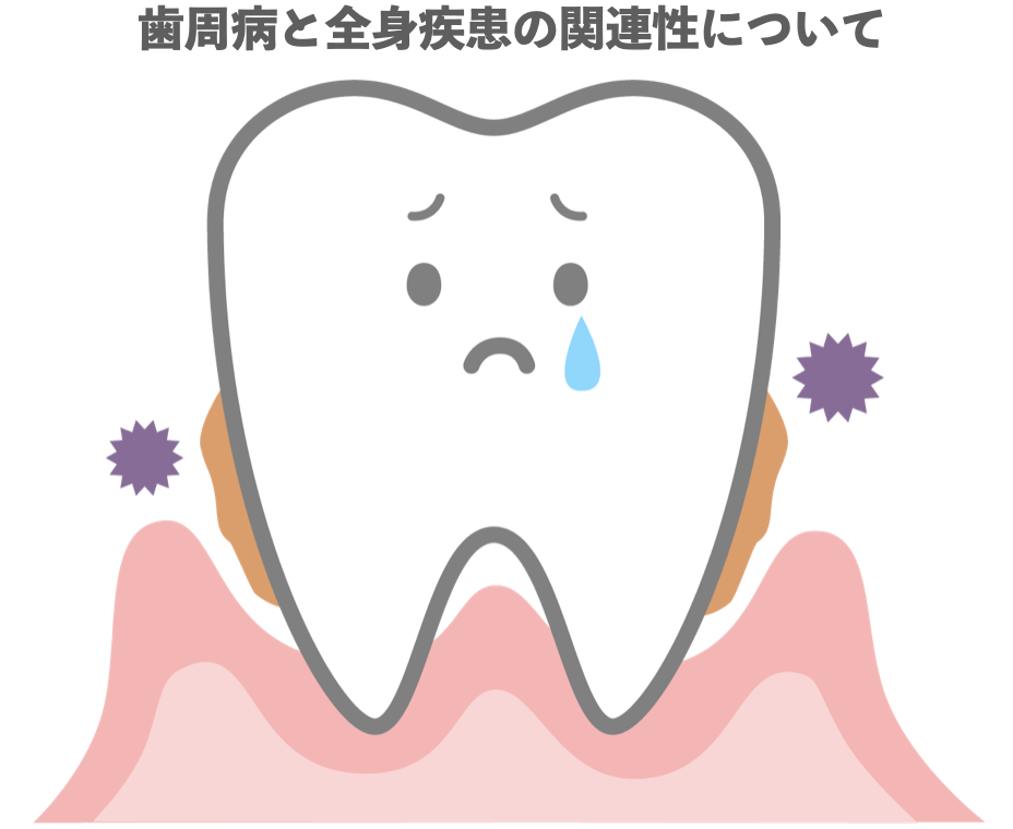 歯周病の絵